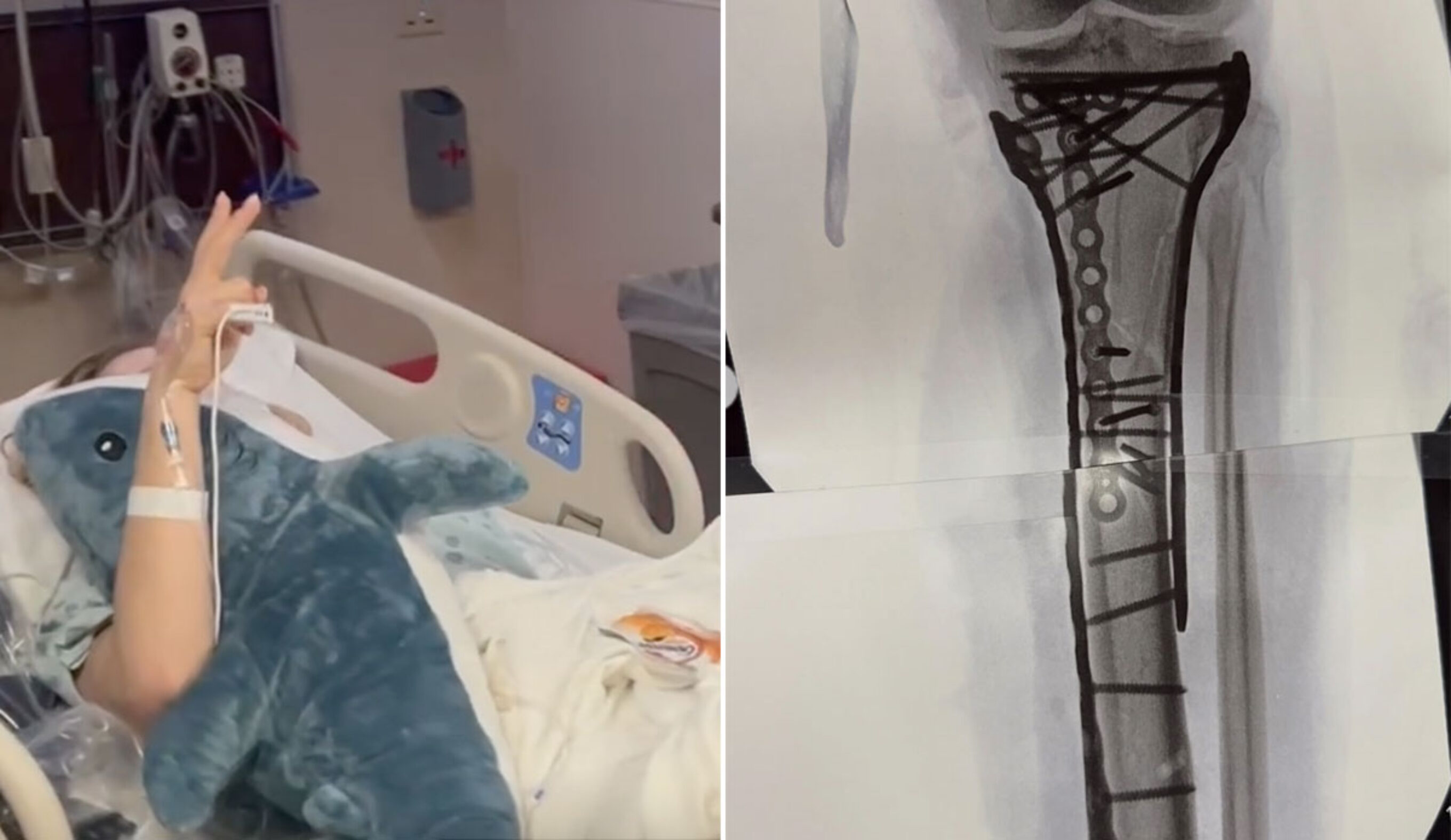 Lindsey Vonn in the hospital after surgery