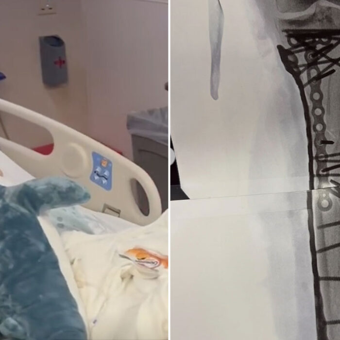 Lindsey Vonn in the hospital after surgery