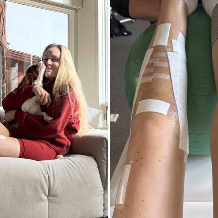 Lindsey Vonn at home recovering from surgery