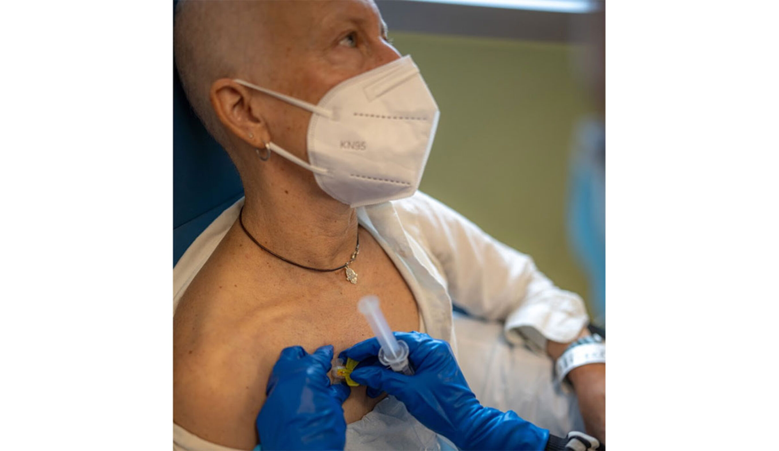 Danielle Cass with chest port for cancer treatment